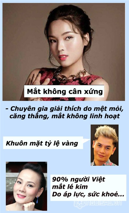 Kỳ Duyên, rùm beng, bủa vây, mắt lệch, ỉ lại, tiếng Pháp, đồ hiệu