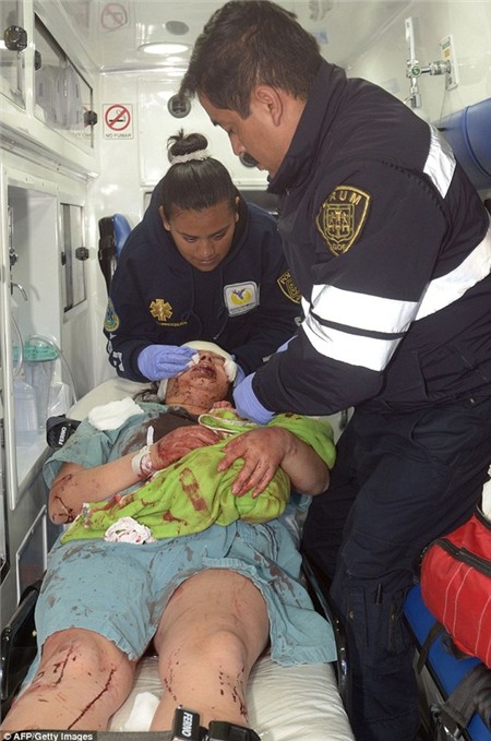 Nổ xe chở gas tại bệnh viện nhi Mexico: Mẹ bị thương nặng vẫn ôm chặt con mới sinh 3