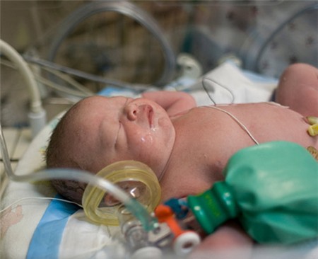 Chuyện những đứa trẻ đã chết bỗng phục sinh kỳ lạ - 2