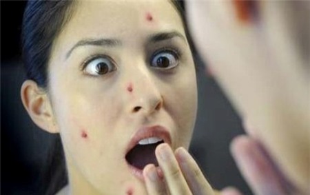 5. Nốt mụn bất ngờ: Thi thoảng bạn thường bị nổi mụn bất ngờ. Để giải quyết chúng nhanh gọn mà không gây kích ứng cho da, bạn có thể dùng một túi trà xanh nhúng nước ấm và đắp vào nốt mụn. Trong trà xanh có chứa catechins là một chất chống oxy hoá giúp kháng viêm đồng thời độ ấm của túi trà có thể giúp tuần hoàn máu xung quanh nốt mụn khiến da mau lành hơn.