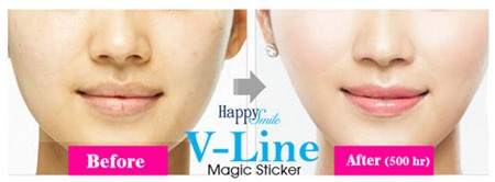 Chị em phát 'sốt' với miếng dán tạo mặt V-line không phẫu thuật - 1