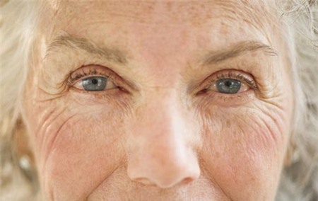 thuật toán, nếp nhăn, bề mặt cong