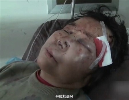 Xin được nhường đường, cụ bà bị người phụ nữ đánh đập dã man 4