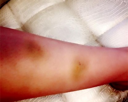 Khánh My, bị cướp, giật đồ, bầm dập