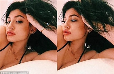 Cô gái bị sưng vù môi do tuỳ tiện mua hàng qua mạng