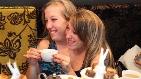 3 cặp song sinh dính liền có cuộc sống ấn tượng nhất thế giới 1