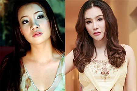 Những biến chứng thường gặp với các phương pháp PTTM đang hot 1