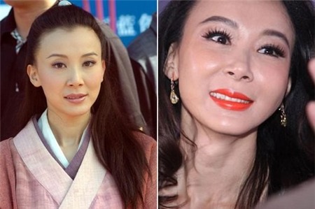 Những biến chứng thường gặp với các phương pháp PTTM đang hot 12