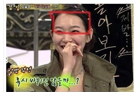 Những biến chứng thường gặp với các phương pháp PTTM đang hot 16