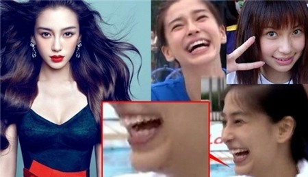 Những biến chứng thường gặp với các phương pháp PTTM đang hot 23