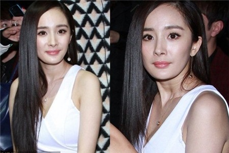 Những biến chứng thường gặp với các phương pháp PTTM đang hot 9