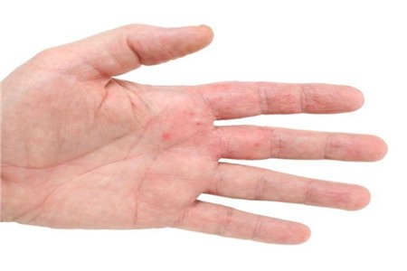 Những bí mật về tình trạng sức khỏe được bộc lộ qua bàn tay bạn 2