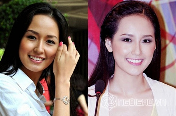 Mỹ nhân Việt khác lạ khi mất răng khểnh 2