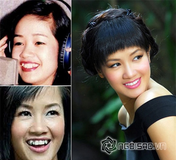 Mỹ nhân Việt khác lạ khi mất răng khểnh 1