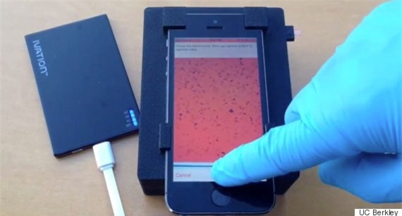 Ứng dụng iPhone giúp rà soát ký sinh trùng trong máu