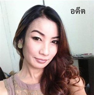 Co gai Thai mu mat sau khi trung tu nhan sac