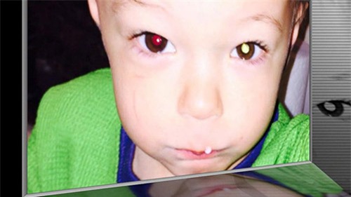 Bố Việt cảnh báo cha mẹ kiểm tra ung thư mắt trẻ bằng iPhone - 1