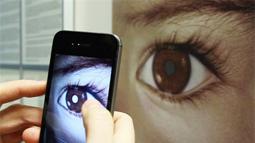 Bố Việt cảnh báo cha mẹ kiểm tra ung thư mắt trẻ bằng iPhone - 3