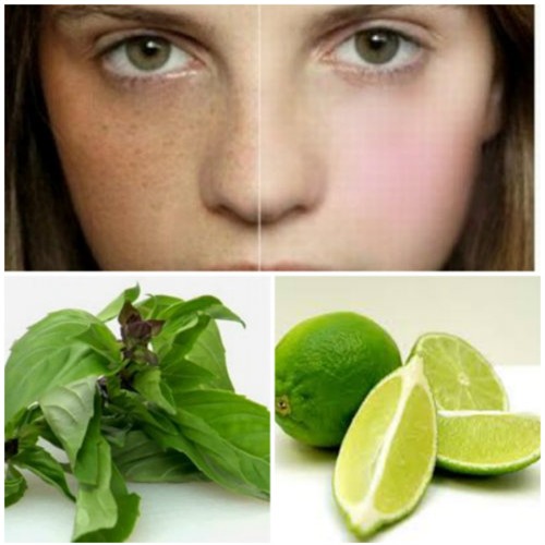 5 cách trị nám da tại nhà với những nguyên liệu cực rẻ - 1