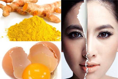 5 cách trị nám da tại nhà với những nguyên liệu cực rẻ - 3