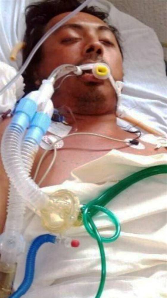 Tử vong sau một lần lỡ dại tự ý tiêm dầu ăn vào ngực