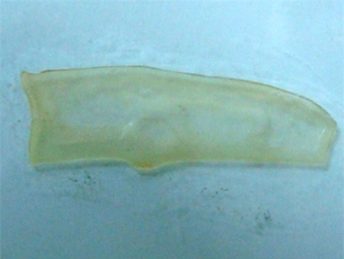 Muôn kiểu giảm cân độc lạ trên thế giới