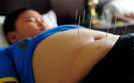 Trung Quoc - “Cuong quoc” beo phi