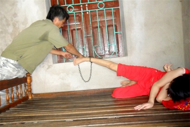 Mỗi khi có việc cần kíp đi ra ngoài, hay khi Nguyệt lên cơn, người cha phải xích chân con lại. Ảnh: Nguyễn Dương.