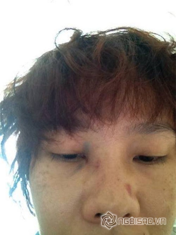 Dương Yến Ngọc bị chồng đánh 6