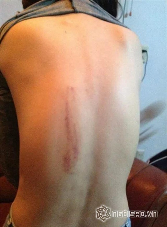 Dương Yến Ngọc bị chồng đánh 8