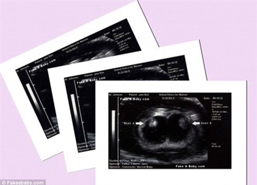 Nữ sinh 16 tuổi giả mang bầu ba thai suốt 10 tháng - 2