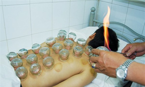 Những đối tượng tuyệt đối không giác hơi -2