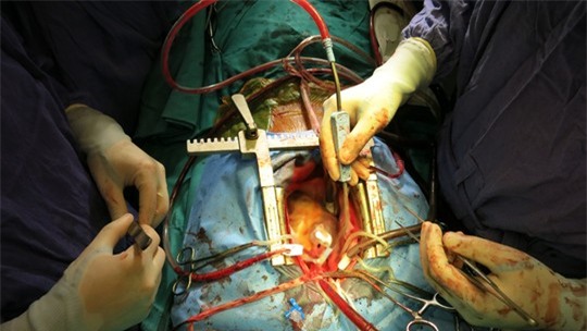 Những hình ảnh lần đầu công bố về ca ghép tạng xuyên Việt - 20