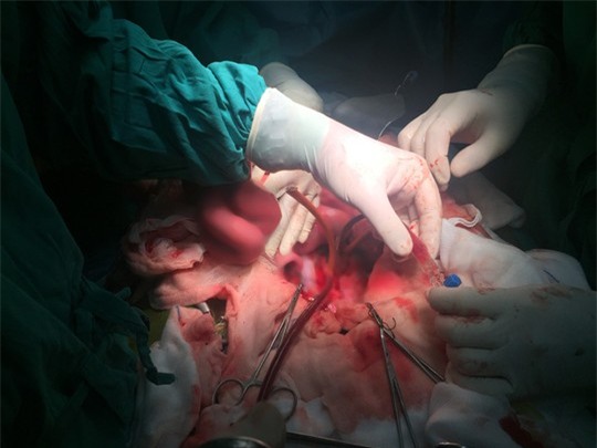 Những hình ảnh lần đầu công bố về ca ghép tạng xuyên Việt - 5