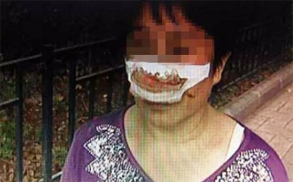 tq: chong can dut mui vo vi khong tra loi dien thoai - 1