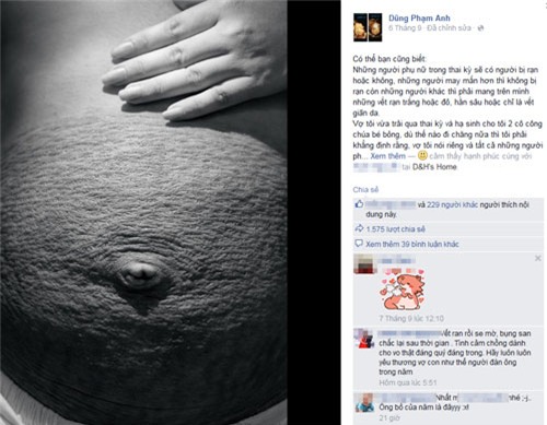 Chồng viết tâm sự về những vết rạn da của vợ gây xúc động - 1