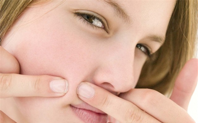 mụn, nặn mụn, mụn đinh râu, mụn đầu đen, mụn thịt