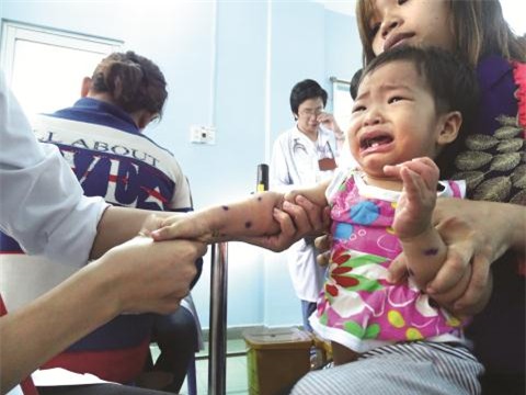 Dich tay -&nbsp;chan - mieng bung phat