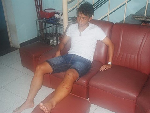 anh khoa sang singapore phau thuat, doi mat nguy co giai nghe hinh anh 1