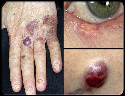 4 loại bệnh để lâu sẽ dẫn đến ung thư - 4