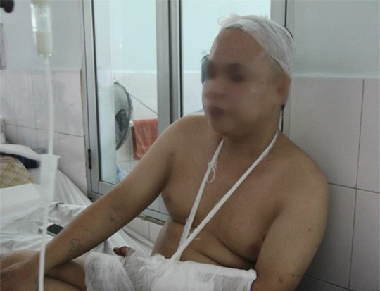 Nạn nhân M. đang điều trị tại bệnh viện (Ảnh: Người lao động)