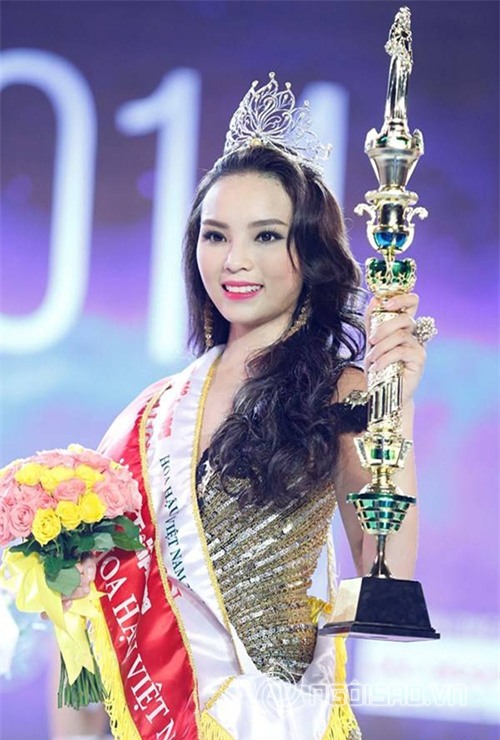 Bằng chứng Hoa hậu Kỳ Duyên tiêm botox v-line 0