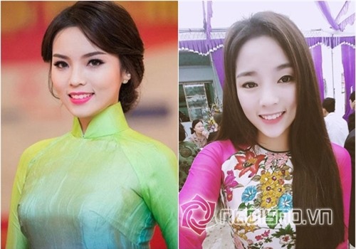 Bằng chứng Hoa hậu Kỳ Duyên tiêm botox v-line 2