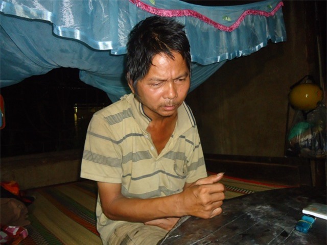 Mỗi ngày anh Thích phải uống 1 liều thuốc an thần và giảm đau, nếu không cơn đau sẽ hành hạ anh đến mụ mị đầu óc