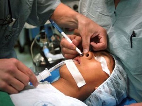 Muốn giữ chồng, nhiều phụ nữ âm thầm đi phẫu thuật thẩm mỹ nhưng lại “lợn lành chữa thành lợn què”