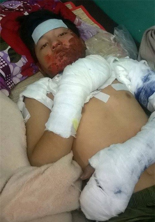 Mẹ tưới xăng đốt con vì trốn học đi chơi game - 1