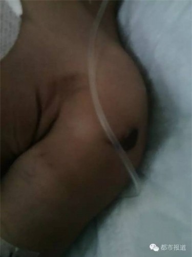 Tình trạng của bé Tân Di hiện vẫn rất nguy kịch sau đòn tra tấn dã man gây ra bởi người tình của mẹ.