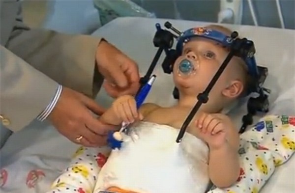 Toddler-Head-Reattached-bdc6a