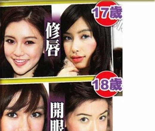 Ngay từ khi gia nhập showbiz cô đã bị đặt nghi vấn thẩm mỹ.