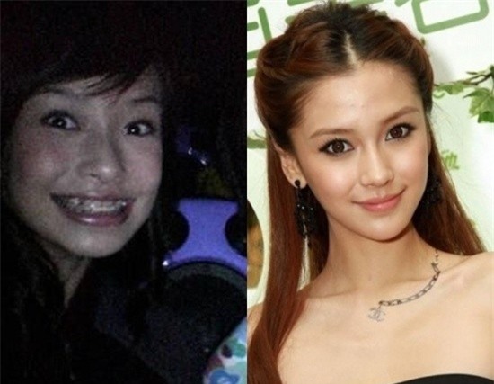 Sự tương phản rất rõ. Nhưng Angelababy luôn phủ nhận chuyện thẩm mỹ.